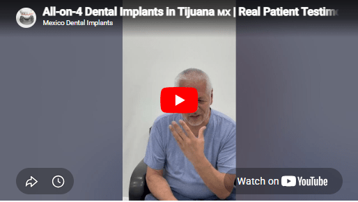 All-on-4 Dental Implants Video Testimonial