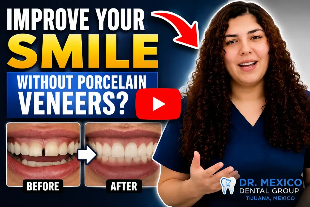 Composite bonding before and after results explained by Dr. Evelyn Tirado at Dr. Mexico Dental Group in Tijuana, Mexico