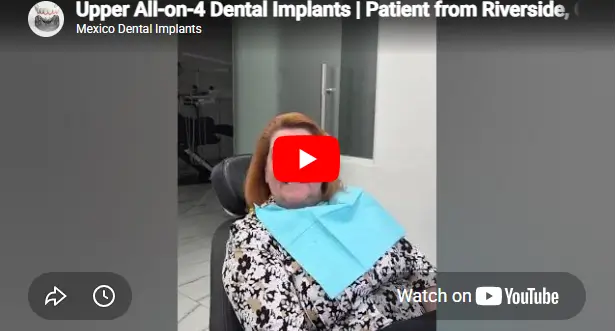 All-on-4 patient Debbie from Riverside, California shares her experience and results after full-mouth dental implant treatment at Dr. Mexico Dental Group.