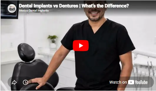 Educational video comparing dental implants and dentures, explaining the differences in stability, comfort, appearance, and long-term oral health benefits.