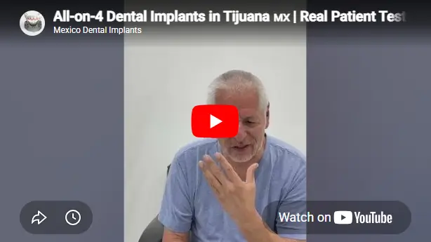 All-on-4 patient Eduardo Gamiz shares his experience and results after full-mouth dental implant treatment at Dr. Mexico Dental Group.