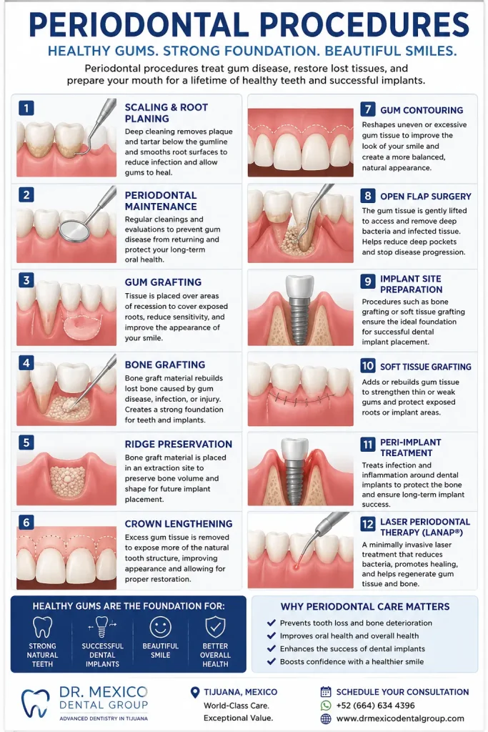 Infographic showing common periodontal procedures including deep cleaning, gum grafting, bone grafting, crown lengthening, implant site preparation, and gum disease treatment in Tijuana.
